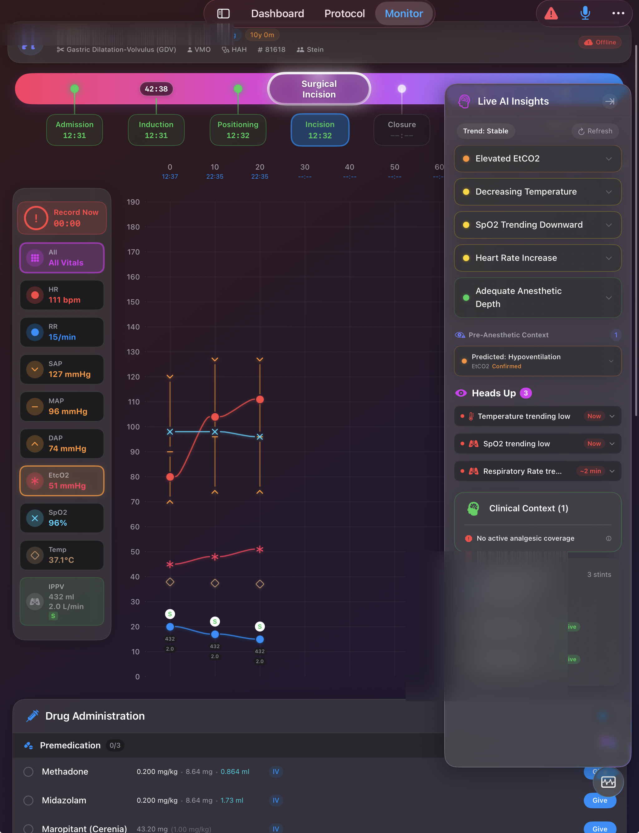 ARCAI OR — Live vitals monitoring with real-time AI interpretation and predictive insights